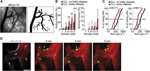 Human CLL cells roll, stick, and crawl within mouse LN HEVs in vivo. (A) Visualization of the mouse inguinal LN microcirculation by intravital microscopy. (B) Rolling and sticking of human CLL cells within mouse LN HEVs. (C) CLL cells from patients with bulky disease roll slower within LN HEVs. (D) Two-photon microscopy time-lapse images showing CLL cells from patients with bulky disease (arrowheads) crawling on HEV endothelium. See the complete Figure 3 in the article by Lafouresse et al that begins on page 1336.