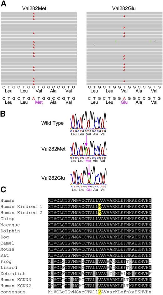Figure 1. Mutation identification. (A) Exome sequencing. Graphical representation of sequence tags from exome sequencing (exon 5) of a kindred 1 HX patient (left), where 17 of 31 full-length reads have an A instead of a G, leading to a missense mutation (Val to Met at amino acid 282), and a kindred 2 HX patient (right), where 41 of 84 full-length reads have an A instead of a T, leading to a missense mutation (Val to Glu at amino acid 282). (B) Sanger sequencing confirmation of KCNN4 gene mutations showing a partial exon 5 wild-type sequence (top), the corresponding sequence from a kindred 1 HX heterozygote (middle), and the corresponding sequence from a kindred 2 HX heterozygote (bottom). (C) Conservation of mutations across vertebrate species. The mutant amino acid residue identified in both HX patients is conserved across vertebrate species, including the clades of placental mammals, the extant Eutherians, and within members of the small-intermediate family of proteins.