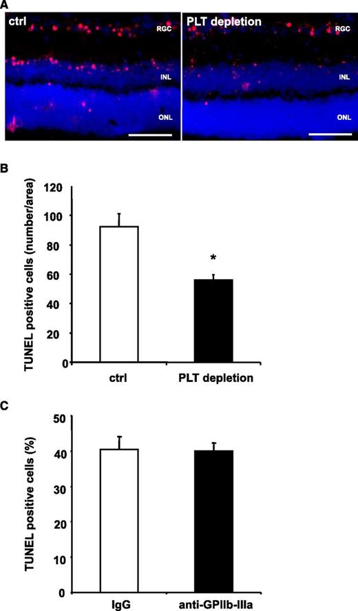 Figure 2. PLT depletion reduces apoptosis in a retinal model with low levels of inflammation, whereas inhibition of GPIIb-IIIa does not affect tissue apoptosis. (A-B) Mice were treated with control serum (ctrl) or PLT-depleting serum (PLT depletion). Subsequently, neuronal apoptosis was induced by intravitreal injection of NMDA. In this model of tissue apoptosis, levels of tissue inflammation are negligible. In retinal sections, TUNEL staining was performed and sections were analyzed in a blinded fashion using immunofluorescence microscopy. Eight non-consecutive sections were analyzed per animal. (A) Shows representative images. (B) Data are mean ± SEM and show the number of TUNEL-positive cells per area (n = 8). *P < .05 vs control treated animals. Scale bar, 100 µm. (C) Stroke was induced in C57BL/6 mice by tMCAO for 60 minutes. Animals were treated with a blocking anti–GPIIb-IIIa F(ab) 1 hour prior to stroke induction. Data are mean ± SEM and show the percentage of TUNEL-positive cells of total cell number per section (n = 5, 3 non-consecutive sections per animal were counted in a blinded fashion). No significant difference was observed between groups. INL, inner nuclear layer; ONL, outer nuclear layer; RGC, retinal ganglion cell.