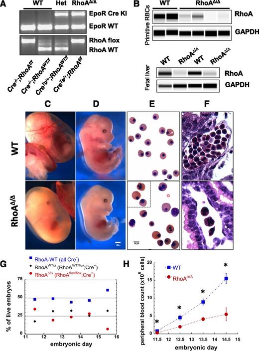 Figure 1. EpoR-CreTg/+; RhoAflox/flox (RhoAΔ/Δ) mice with erythroid-specific RhoA deficiency die in utero by E16.5 because of failure of definitive erythropoiesis. (A) Representative results of embryo genotyping by PCR (somatic DNA) show bands for EpoR-Cre (top, WT:431bp, Cre+:679bp) and RhoA (bottom, WT:482bp, flox:633bp) for all possible genotypes of the offspring of an EpoR-CreTg/+;RhoAWT/flox × EpoR-Cre−/−;RhoAflox/flox timed pregnancy. (B) Immunodetection of RhoA protein in peripheral WT and RhoAΔ/Δ blood cells from E11.5 embryos (top panel) and in CD71+ cells from WT and RhoAΔ/Δ E13.5 fetal livers (bottom panel), using a size-based capillary electrophoresis instrument, shows significant reduction of RhoA in the RhoAΔ/Δ embryos. (C-D) Stereoscopic images of E13.5 embryos showing severe anemia in RhoAΔ/Δ yolk sac (C), as well as pallor and small fetal liver in RhoAΔ/Δ embryos (D). The scale bar represents 1 mm. (E-F) Light microscopy images of peripheral blood cytospins showing poikilocytosis with large and frequently multinucleated primitive RhoAΔ/Δ erythroid cells in contrast to the homogeneous population of WT primitive red cells (E); hematoxylin and eosin–stained yolk sacs show the paucity of primitive erythroid cells in the RhoAΔ/Δ yolk sac vessels (F). The scale bar represents 10 µm. (G) The offspring of EpoR-CreTg/+;RhoAWT/flox × EpoR-Cre−/−;RhoAflox/flox follow Mendelian ratios up to E14.5. By E15.5, only 6% of live embryos are RhoAΔ/Δ, with none being alive by E16.5. Data based on genotyping of >60 embryos per each time point. (H) RhoAΔ/Δ embryos exhibit anemia already by E11.5, worsening significantly by E14.5. Data are represented as mean ± SEM of blood counts for at least 3 embryos per genotype per each time point. *P < .05 of RhoAΔ/Δ vs WT.