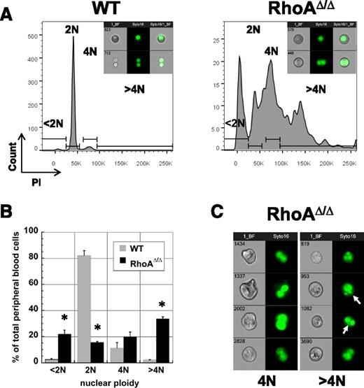 Figure 2. RhoAΔ/Δ primitive erythroid cells are often multinuclear. (A) PI staining of E12.5 primitive circulating erythroid cells reveals a significant number of 4N, >4N, as well as <2N cells in the RhoAΔ/Δ population compared with the almost exclusively 2N cells of the WT population. The graphs are representative of 3 biological repeats. Insets: representative imaging flow cytometry pictures of brightfield and Syto-16–stained WT and RhoAΔ/Δ primitive erythroid cells within the 2N (top) and 4N gate (bottom). (B) Graphic representation as mean ± SEM from the data of 3 experiments (3 different biological repeats) of PI staining of E12.5 primitive erythroid cells. *P < .005 of RhoAΔ/Δ vs WT. (C) Imaging flow cytometry reveals that tetraploid (4N) and >4N RhoAΔ/Δ primitive erythroid cells do not appear to be undergoing mitosis. Cells were stained with the nuclear stain Syto16. Micronuclei or nuclear fragments (arrows) can be observed in the >4N population.