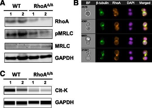 Figure 5. RhoA regulates myosin regulatory light-chain phosphorylation and microtubule organization during erythroblast cytokinesis. (A) Myosin regulatory light-chain phosphorylation is decreased in E14.5 RhoAΔ/Δ fetal liver cells as shown by western blotting. (B) RhoA colocalizes with β-tubulin in WT erythroblasts undergoing mitosis, possibly participating in the formation of the microtubule-derived midbody structure observed in cytokinesis. The nuclear stain DAPI was used to indicate the nucleus. Four representative cells are shown of at least 30 dividing cells with similar morphology. Images were obtained with a 60× objective lens by ImageStreamX. (C) Citron kinase was significantly decreased in E13 RhoAΔ/Δ Ter119+ fetal liver cells, as shown by capillary electrophoresis and immunodetection.