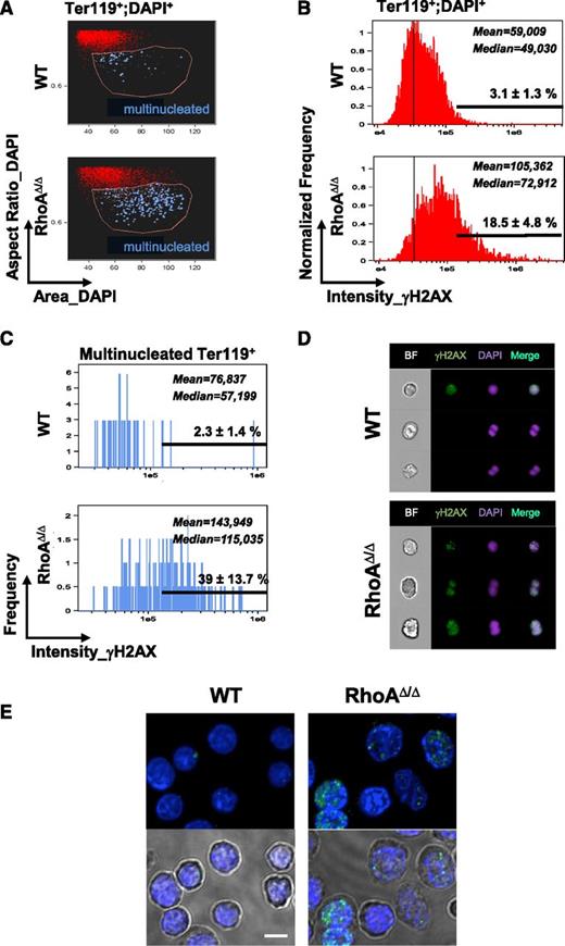Figure 6. Cytokinesis failure results in DNA damage in RhoAΔ/Δ fetal liver erythroblasts, as evidenced by staining for the DNA damage marker γH2AX. (A) Fetal liver cells from E14.0 WT and RhoAΔ/Δ embryos were analyzed by imaging flow cytometry as shown before,18 up to the gating of erythroblasts (Ter119+DAPI+ cells). Further analysis based on the size of the nucleus (area_DAPI) and the shape of the nucleus (aspect ratio_DAPI=ratio of the minor axis/major axis) gave a population (gated by the pink line) enriched in binucleated cells. Truly binucleated or multinucleated cells were then identified by visual observation and marked blue in the dot plot. (B-C) Concurrent staining for the DNA damage marker γH2AX revealed that γH2AX, as measured in arbitrary units of fluorescence, was significantly higher in the RhoAΔ/Δ erythroblasts compared with WT. Considering a threshold for H2AX positivity at 1.5 × 105, the percentage of γH2AX-positive cells was 18.5 ± 4.8% for RhoA∆/∆ Ter119+ nucleated fetal liver cells vs 3.1 ± 1.3% for the WT counterparts (B). The difference was more significant in the multinucleated erythroblasts: 39 ± 13.7% in RhoAΔ/Δ vs 2.3 ± 1.4% in the WT (C). Mean and median values of the fluorescence intensity of γH2AX in the WT and RhoAΔ/Δ erythroid precursors are shown (P < .0001 of RhoAΔ/Δ vs WT). At least 5000 Ter119+;DAPI+ cells were analyzed in each experiment and results are representative of 3 biological repeats for each genotype. (D) Binucleated RhoAΔ/Δ cells were strongly positive for γH2AX, indicative of DNA damage. In contrast, binucleated WT cells were negative for γH2AX and likely normal mitotic cells. Three representative cells are shown for each genotype of at least 250 RhoAΔ/Δ and 40 WT hyperdiploid cells with similar morphology. Images were obtained with a 60× objective lens by ImageStreamX. DAPI was used as a nuclear stain. (E) Fetal liver cells from E14 embryos were stained for γH2AX foci and imaged by confocal microscopy. Cells with >4 foci per nucleus were counted as positive, and at least 50 cells were evaluated per sample. The percentage of γH2AX-positive cells was 38.5% for RhoA∆/∆ vs 2% for the WT. Bottom panels show the nuclear stain merged with the corresponding brightfield image to demonstrate the binucleated and dysplastic RhoA∆/∆ cells. The scale bar represents 10 µm.