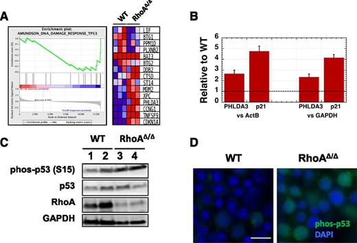 Figure 7. DNA damage in RhoAΔ/Δ fetal liver erythroblasts leads to p53 and caspase activation. (A) Gene Set Enrichment Analysis (GSEA) from RNA-Seq data of CD71+ cells isolated from E13.0 WT and RhoAΔ/Δ fetal livers (n = 3 for each genotype) demonstrating upregulation of p53-related DNA damage response genes39 in the RhoA-deficient erythroblasts. (B) The upregulation of PHLDA3 and p21 (CDKN1A) mRNA found by RNA-Seq was confirmed using RT-PCR on RNA isolated from CD71+ cells from E13.0 WT and RhoAΔ/Δ fetal livers (n = 3 for each genotype). Data are represented as mean ± SEM of fold-expression relative to WT; expression normalized vs Actin-B and vs glyceraldehyde-3-phosphate dehydrogenase (GAPDH) is shown. (C) Increased p53 phosphorylation at Ser-15 is demonstrated by western blotting in CD71+ cells isolated from E13.0 RhoAΔ/Δ fetal livers compared with WT. (D) Immunostaining on fetal liver touch-preps further confirmed increased phosphorylation of p53 phosphorylated at Ser-15 in E13.0 RhoAΔ/Δ fetal liver cells. The scale bar represents 10 µm.