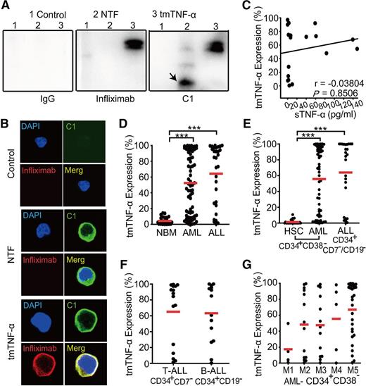 Figure 1. Preferential expression of tmTNF-α in leukemia cells. (A) Lysates of Jurkat cells transfected with control, N-terminal truncated fragment (NTF), or tmTNF-α plasmid were precipitated with C1 and then were analyzed by western blotting. Infliximab and IgG served as controls. The image of immunoprecipitation (IP)-western blot is representative of 3 independent experiments. Infliximab bound only tmTNF-α protein but not NTF (middle panel). C1 could bind both tmTNF-α and NTF (black arrow) protein (right panel). Mouse IgG1 could not bind tmTNF-α or NTF protein (left panel). (B) tmTNF-α-negative Jurkat cells were transfected with control, NTF, or tmTNF-α plasmid and stained with fluorescence in situ hybridization, fluorescein isothiocyanate–conjugated C1 and phycoerythrin-conjugated infliximab. The image of confocal microscopy (magnification, ×1000) is representative of 3 independent experiments. (C) A scatter plot shows the percentages of tmTNF-α+ leukemia cells vs levels of serum sTNF-α in 18 patients with de novo AL. tmTNF-α expression was analyzed by flow cytometry using C1 in BM mononuclear cells from 69 AML, 30 ALL, and 30 nonmalignant donors (D), in CD34+CD38– or CD34+CD7–/CD19– fractions of AML, ALL, or nonmalignant cells (E), in CD34+CD7– (for T-ALL, n = 16) or CD34+CD19– (for B-ALL, n = 14) fractions of ALL (F), and in CD34+CD38– fractions among various French-American-British classification systems (FAB) AML subtypes (G). Data represent means ± SEM. ***P < .001 vs NBM (D) or HSC (E).