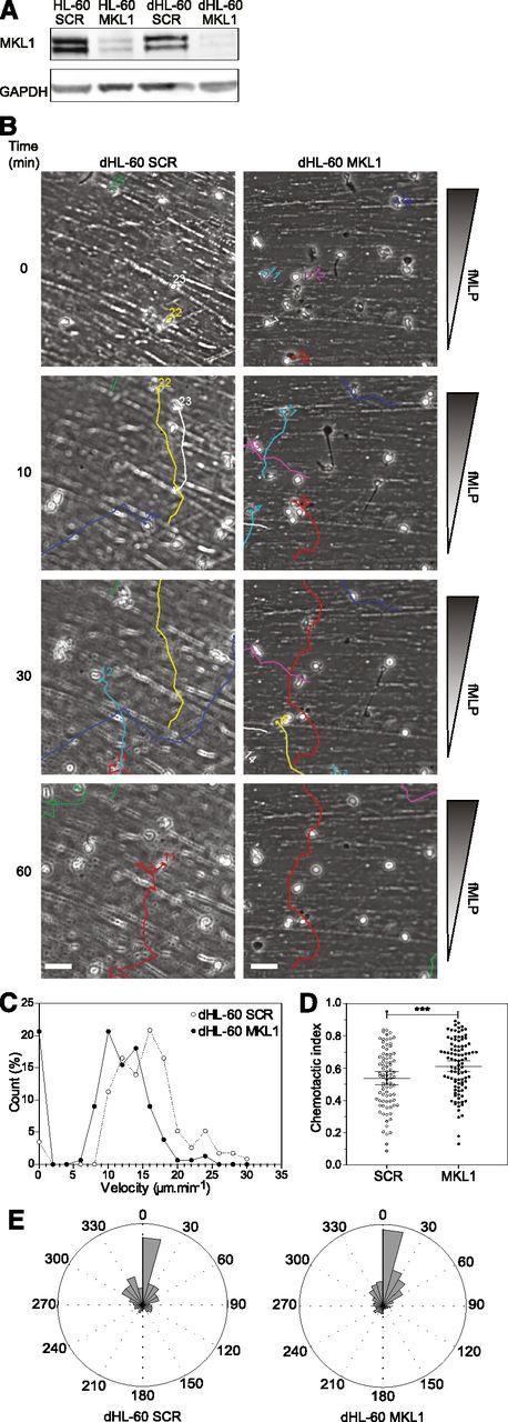Figure 3. Knockdown of MKL1 in HL-60 neutrophil-like cells mimics patient phenotype. HL-60 cells were differentiated into neutrophil-like cells for 5 days in culture media containing 1.3% dimethylsulfoxide. (A) Western blot of the MKL1 expression levels in undifferentiated (HL-60) or differentiated (dHL-60) cells carrying SCR or the shRNA against MKL1 (MKL1). (B) Migration of SCR and MKL1 neutrophils in a Dunn chamber in response to an fMLP gradient. Tracks show migration path over time. Scale bar = 20 μm. (C) Frequency distribution of the velocity of dHL-60 SCR and MKL1 cells during migration in a Dunn chamber in response to fMLP. The number of cells analyzed was 115 for SCR and 156 for MKL1 cells in 3 independent experiments. (D) Chemotactic index of dHL-60 SCR and dHL-60 MKL1 cells during migration in a Dunn chamber. (E) Instant angle distribution during the migration of SCR and MKL1 dHL-60 cells. ***P < .001.