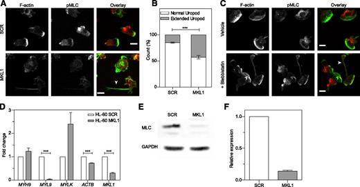 Figure 7. MKL1-deficient dHL-60 cells show impaired uropod retraction associated with downregulation of MYL9. (A) Knockdown of MKL1 induces a uropod retraction defect. dHL-60 cells were left to adhere to fibronectin-coated glass coverslips for 20 minutes, washed, then uniformly stimulated with fMLP for 2 minutes and fixed in 4% paraformaldehyde. Cells were then stained for F-actin and phosphorylation of MLC (pMLC). The dHL-60 MKL1 F-actin staining intensity was increased threefold in the merged (overlay) image. Images were taken with an ×40 lens. White arrow indicates extended uropod. (B) Quantification of the frequency of uropod extension in dHL-60 MKL1 cells observed in (A). More than 250 cells were analyzed in each condition in 2 independent experiments. (C) Inhibition of myosin II interaction with F-actin using blebbistatin (100 µM) induced a uropod retraction defect in dHL-60 WT cells. Images were taken with a ×63 lens. Scale bars = 10 μm. (D) mRNA expression in HL-60 SCR and MKL1 cells analyzed by qRT-PCR. (E-F) Myosin light chain expression was evaluated by western blot. ***P < .001.