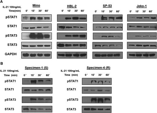 Figure 2. IL-21 induces activation of STAT1 and STAT3 in MCL cell lines and primary tumors. For (A-B), MCL cell lines (Mino, HBL-2, SP-53, and Jeko-1) and primary tumors (specimens 1 and 4) were treated with IL-21 (100 ng/mL) for the indicated time periods. Whole cell lysates were prepared and subjected to immunoblotting to measure the levels of phosphorylated STAT1 and STAT3. Immunoblotting for nonphosphorylated STATs and glyceraldehyde-3-phosphate dehydrogenase (GAPDH) served as loading controls. Results in panels A-B are representative of 3 independent experiments.