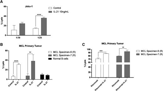 Figure 5. IL-21 increases NK-cell–mediated lysis of MCL cells. Enriched human NK cells from peripheral blood were incubated with 51Cr-labeled (A) Jeko-1 and (B) MCL primary tumor cells coated with IL-21 at various effector/target ratios as described in “Materials and methods.” In (C), 51Cr-labeled MCL primary tumor cells were coated with rituximab alone or in the presence of IL-21, followed by incubation with NK cells at variable effector/target ratios. Percentage of specific lysis was derived from 51Cr released by target cells. Data are representative of 3 independent experiments. Error bars represent SD between triplicate wells. *P < .05; **P < .01; ***P < .0005; ****P < .0001.