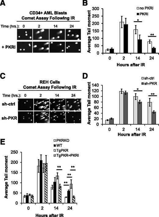 Figure 5. Inhibition of PKR expression or activity promotes DNA DSB repair in hematopoietic cells. Neutral Comet assays were used to measure DNA DSB repair following 5 Gy IR. (A) Inhibition of PKR by treatment with 0.5 μM PKRI prior to and following IR promoted faster kinetics of DNA DSB repair in primary CD34+ AML cells. SYBR gold-stained Comets were visualized by microscopy (×40). A representative Comet assay of 1 patient sample is shown. (B) The average Comet Olive Tail Moment from 50 randomly chosen CD34+ AML cells in each of 6 patient samples was determined. (C) Representative Comet assay, and (D) calculation of the average Comet Tail Moment of 50 randomly chosen REH cells demonstrates reduced PKR expression (sh-PKR) increases the rate of DNA DSB repair compared with control (sh-ctrl) cells. (E) Lin− BM cells were collected from WT, TgPKR, and PKRKO mice, and treated with 5 Gy IR. Comet Tail Moments were calculated from 50 randomly chosen cells for each genotype. Lin− BM cells from PKRKO mice displayed more rapid kinetics of DNA DSB repair than WT cells. Compared with WT, TgPKR cells exhibit delayed DNA DSB repair that can be restored by treatment with 0.5 μM PKRI. *P < .05; **P < .01.