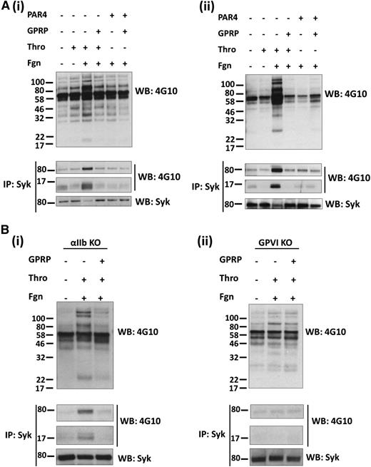 Figure 1. Fibrin stimulates tyrosine phosphorylation in a GPVI-dependent manner. Platelets from (Ai) human, (Aii) mice, (Bi) αIIb-deficient mice, and (Bii) GPVI-deficient mice were stimulated with thrombin (1 U/mL) or PAR-4 peptide (150 μM) in the presence of eptifibatide and, where shown, fibrinogen (200 μg/mL) and GPRP (5 μM). Stimulations were stopped after (A) 1 or (B) 3 minutes with the addition of 2× lysis buffer. A sample of the WCL was removed, and the remaining lysate was used to IP Syk. WCLs and IPs were separated by SDS-polyacrylamide gel electrophoresis and western blotted for pTyr, Syk, and the FcRγ chain, which coprecipitates with Syk. The results are shown as representative of 3 experiments.