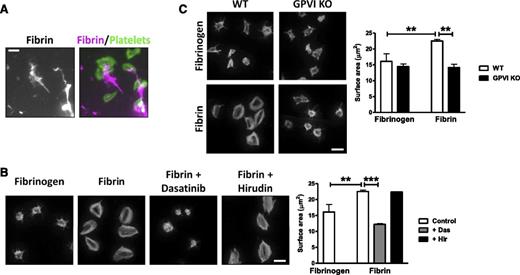 Figure 2. Fibrin stimulates spreading in a GPVI-dependent manner. Fibrinogen was coated onto glass coverslips and converted into fibrin by treatment with thrombin. Hirudin was used to neutralize any residual thrombin before washing and blocking. (A) Alexa-488 fibrinogen was used to visualize fibrin formation. Platelets (2 × 107/mL) were allowed to spread on coated coverslips, followed by actin staining with Alexa-568 phalloidin. Scale bar, 5 μm. (B) Platelets (2 × 107/mL) were allowed to spread on nonfluorescent fibrinogen or fibrin-coated coverslips, followed by actin staining with Alexa-488 phalloidin. Where shown, platelets were preincubated with dasatinib (10 μM) or hirudin (5 U/mL). Scale bar, 5 μm. (C) WT or GPVI KO platelets were allowed to spread on fibrinogen or fibrin-coated coverslips, followed by actin staining with Alexa-488 phalloidin. Scale bar, 5 μm. The results are shown as mean ± standard error of the mean (SEM) of 3 experiments. **P < .01; ***P < .001.