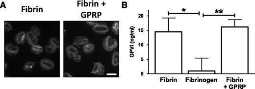 Figure 3. Fibrin polymerization is not essential for platelet spreading or GPVI binding. (A) Fibrinogen was coated onto glass coverslips and converted into fibrin by treatment with thrombin. GPRP (5 μM) was used to inhibit polymerization of fibrin monomers. Hirudin was used to neutralize any residual thrombin before washing and blocking. Platelets (2 × 107/mL) were allowed to spread, followed by actin staining with Alexa-488 phalloidin. Scale bar, 5 μm. The results are representative of 3 experiments. (B) Fibrinogen was coated onto the wells of Nunc Maxisorp plates and converted into fibrin by treatment with thrombin. GPRP (5 μM) was used to inhibit polymerization of fibrin monomers. The ectodomain of GPVI was incubated, and following washing, adherent GPVI was detected with a HRP-conjugated antibody. The results are shown as mean ± SEM of 3 experiments performed in duplicate. *P < .05; **P < .01.