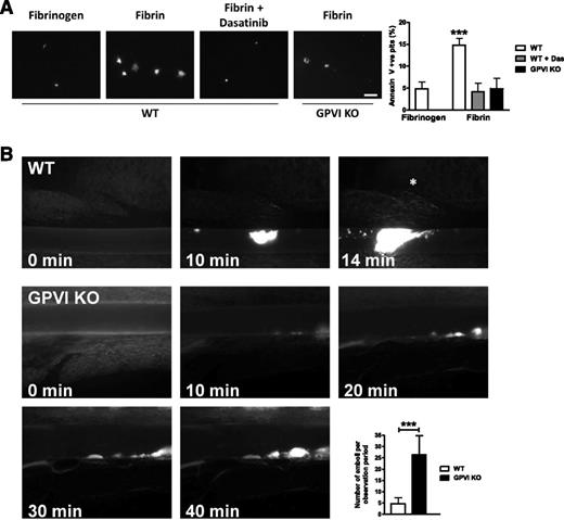 Figure 4. GPVI KO platelets have reduced PS exposure and reduced thrombus stability. (A) WT or GPVI-deficient platelets were allowed to spread on fibrinogen or fibrin-coated coverslips, followed by incubation with FITC-Annexin V. Actin was counterstained with Alexa-568 phalloidin to count total number of adherent platelets (data not shown). Scale bar, 20 μm. The results are shown as mean ± SEM of 3 experiments. (B) Representative fluorescent images before and after injury. Asterisk indicates vessel occlusion. Embolization rate was determined by counting embolized thrombus fragments (size > 10 µm) after an initial thrombus had formed (thrombus size ≥ 10 µm). Observation period: 40 minutes or until vessel occlusion. The results are shown as mean ± standard deviation of ≥6 mice. ***P < .001.