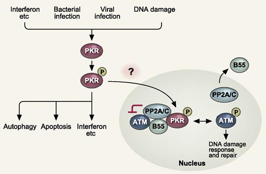 PKR in the cytoplasm is activated by multiple stimuli, such as cytokines (IFNs, etc), bacterial and viral infection, and DNA damage. Active PKR triggers production of IFNs and proinflammatory cytokines, apoptosis, and autophagy. In this study, Cheng et al showed that nuclear PKR activates PP2A by promoting nuclear localization of the regulatory B subunit (B55α). Activated PP2A in turn antagonizes autophosphorylation and activation of ATM, thereby inhibiting DNA damage response. P indicates phosphorylation. See Figure 4I in the article by Cheng et al beginning on page 1585.
