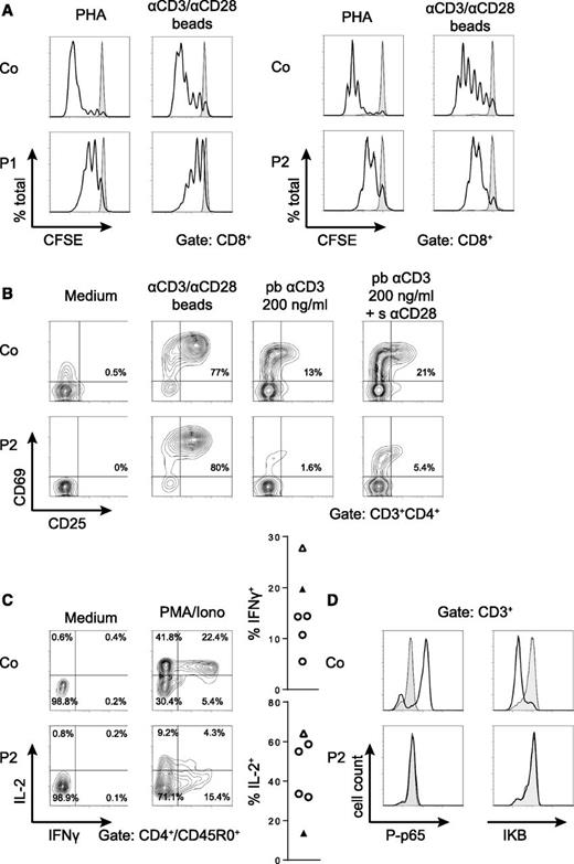 Figure 3. A T-cell activation defect affecting the NF-κB pathway. (A) Proliferation of CD8+ T cells from P1 and P2 measured by carboxyfluorescein succinimidyl ester dilution after a 6-day stimulation of PBMC with PHA or anti–CD3/CD28-coated beads (black line). Unstimulated cells are represented by the gray area. Similar results were obtained for CD4+ T cells. Proliferation assays were performed twice with similar results. (B) Early T-cell activation as assessed by CD25/CD69 expression in P2 CD4+ T cells upon overnight stimulation of PBMC with the indicated stimuli. (C) Percentages of IL-2 and IFNγ producing CD45RO+ CD4+ T cells from a day control and P2 measured after a 4-hour stimulation of PBMC with PMA/ionomycin in the presence of Brefeldin A. Graphs represent data from 4 different healthy controls (open circles), the day control (open triangles), and the patient (black triangle). (D) Phosphorylation of p65 (left panel) and degradation of IκB (right panel) in T cells from P2 and a healthy control after stimulation with PMA/ionomycin for 15 minutes (black line) compared with medium control (gray area). All activation assays (B-D) were performed at least 3 times with similar results.