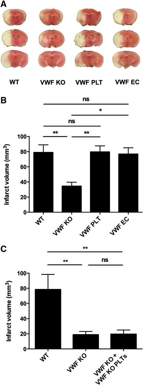 Figure 4. Platelet-derived VWF alone mediates ischemic stroke injury. Transient focal cerebral ischemia was induced by 60 minutes occlusion of the right middle cerebral artery, followed by 23 hours of reperfusion in WT (n = 12), VWF KO (n = 10), VWF PLT chimeric (n = 16), and VWF EC chimeric (n = 9) mice. (A) Representative 2,3,5-triphenyltetrazolium chloride staining of 3 consecutive coronal brain sections 24 hours after induction of transient middle cerebral artery occlusion (tMCAO) are shown. White color indicates infarcted area, whereas a pink color shows unaffected brain tissue. (B) Brain infarct volumes as quantified by planimetric analysis 24 hours after tMCAO. (C) To exclude potential irradiation-mediated effects on cerebral injury, transient focal cerebral ischemia was induced in irradiated VWF KO mice transplanted with MNCs derived from VWF KO mice (VWF KO + VWF KO PLTs). Planimetric analysis of brain infarct volumes 24 hours after tMCAO in WT (n = 5), VWF KO (n = 7), and VWF KO + VWF KO PLTs chimeric mice (n = 7). ns, not statistically significant. *P < .05; **P < .01.
