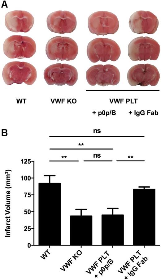 Figure 5. Blockade of platelet GPIbα reduces platelet VWF-mediated ischemic stroke injury. Transient focal cerebral ischemia was induced by 60 minutes occlusion of the right middle cerebral artery, followed by 23 hours of reperfusion in nontreated WT (n = 6) and VWF KO (n = 5) mice, and VWF PLT chimeric mice treated with 100 μg anti-GPIbα Fab (+ p0p/B; n = 8) or rat IgG Fab control (+ IgG Fab; n = 12). (A) Representative 2,3,5-triphenyltetrazolium chloride staining of 3 consecutive coronal brain sections 24 hours after transient middle cerebral artery occlusion (tMCAO). White color indicates infarcted area, whereas a pink color shows unaffected brain tissue. (B) Brain infarct volumes as quantified by planimetric analysis 24 hours after tMCAO. ns, not statistically significant. **P < .01.