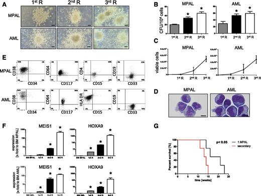 Figure 5. Immortalization ex vivo and increased oncogenic potential through CFC assays of MLL edited acute leukemia cells. CFC assays were performed to assess the replating efficiency of leukemic cells ex vivo in semisolid medium. Scale bars define 100 µm. (A) Images show representative morphologies of compact colonies displaying increased density after each replating. (B) Bar graph represents the mean number of colonies generated per 104 seeded cells. (C) Plot indicates cell numbers after each replating. Pooled data from 3 independent experiments. (D) Representative morphologies and phenotypes (E) are shown for colony-forming cells. Scale bar defines 10 µm. (F) Representative qPCR analyses of MLL target genes show increasing levels after each replating in CFC assays. Results from 1 of 3 independent experiments performed in triplicate. (G) Kaplan-Meier plot is shown for each cohort of animals (direct inject = 4 and secondary inject = 4). *P < .05 was considered statistically significant. Error bars indicate SEM. CFU, colony-forming unit; R, round.