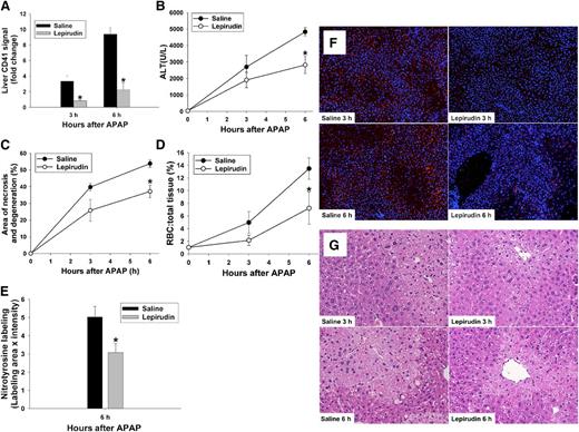 Figure 2. Effect of lepirudin on APAP hepatotoxicity. Mice were treated with 300 mg/kg APAP or vehicle IP at time 0 hour. Lepirudin (1 mg/kg) or saline was given IP at −0.5 hour, and at +0.5, +2.5, and +4.5 hours relative to administration of APAP. (A) Hepatic CD41 signal at 3 and 6 hours, intensity normalized to the CD41 signal of WT mice that were not treated with either APAP or lepirudin. (B) ALT activity in plasma. (C) Area of necrosis and degeneration as a percentage of total liver area. (D) RBC to total cell (%) in sections of liver tissue. (E) Nitrotyrosine label at 6 hours quantified as described in “Materials and methods.” (F) Representative photomicrographs of frozen liver sections labeled with anti-CD41 antibody to identify platelets, using 4,6 diamidino-2-phenylindole stain to identify nuclei. Platelets are pseudocolored red; nuclei are pseudocolored blue. (Original magnification ×100) (G) Representative liver sections from each group at 3 and 6 hours after APAP injection. (Original magnification ×200). *Significantly different from the saline-pretreated group at same time (N = 4 mice per group for each treatment/time).