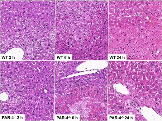 Figure 6. APAP-induced liver injury in WT and PAR-4−/− mice. Mice were treated as mentioned in the legend to Figure 5. Representative sections from WT and PAR-4−/− mice taken 2, 6, or 24 hours after treatment with APAP (original magnification ×200).