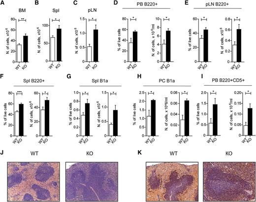 Figure 3. Old GILZ KO mice develop a chronic B-cell lymphocytosis. (A-C) Number of cells in BM (A), spleen (B), and pLN (C) isolated from 13- to 19-month-old WT and gilz KO mice (n = 9/10). (D) Frequency (left) and number (right) of B220+ cells in PB isolated from 13- to 19-month-old WT and gilz KO mice (n = 9/10). (E) Frequency (left) and number (right) of B220+ cells in pLN isolated from 13- to 19-month-old WT and gilz KO mice (n = 9/10). (F) Frequency (left) and number (right) of B220+ cells in spleen isolated from 13- to 19-month-old WT and gilz KO mice (n = 9/10). (G) Frequency (left) and number (right) of B1a (B220loIgM+IgD–CD43+CD5+) cells in spleen isolated from 13- to 19-month-old WT and gilz KO mice (n = 9/10). (H) Frequency (left) and number (right) of B1a cells in peritoneum (PC) isolated from 13- to 19-month-old WT and gilz KO mice (n = 9/10). (I) Frequency (left) and number (right) of B220+CD5+ cells in blood isolated from 13- to 19-month-old WT and gilz KO mice (n = 4). (J) Spleen histologic phenotype of 18-month-old WT and gilz KO mice assessed by hematoxylin and eosin (H&E) staining. Scale bars represent 100 µm; original magnification ×20. (K) Immunohistochemical analyses show that the number of CD45R/B220+ lymphocytes in spleen is increased in gilz KO compared with WT mice. Scale bars represent 100 µm; original magnification ×20.