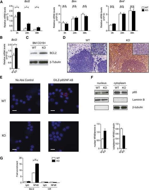 Figure 6. Lack of GILZ enhances NF-κB transcriptional activity and Bcl-2 expression. (A) qPCR analysis of Bcl2, Bim, and Bmf mRNA expression in CD19+ BM cells cultured in vitro for the time indicated in the graph. (B) qPCR analysis of Bcl2 mRNA expression in CD19+ cells isolated from the BM of WT and KO mice (n = 6). Data are presented relative to the expression of Actb mRNA. (C) WB analysis of Bcl2 expression in purified B cells isolated from WT and gilz KO mice. (D) Immunohistochemical analyses show that the number of Bcl-2+ cells in spleen is increased in gilz KO compared with WT mice. Scale bars represent 100 µm; original magnification ×20. Insets in the upper right image represent higher magnification images (40×). (E) Images of in situ proximity ligation assay (PLA) performed on CD19+ cells isolated from the BM of WT mice. PLA was carried out in the absence (left) or presence (right) GILZ-p65/NF-κB primary antibodies mix. The right panel shows a representative merge of the red (PLA) and blue nuclear counterstain (DAPI) channels images. The red spots indicate close proximity (<40 nm) between bound antibodies. Scale bars represent 20 µm. (F) WB analysis of p65 expression in purified B cells isolated from WT and gilz KO mice. The same number of cells was loaded; WB with β-tubulin and laminin B antibodies served as loading control. The graph below represents densitometric analysis of NF-κB expression relative to housekeeping controls (n = 2). (G) Chromatin IP assay of NF-κB binding on proximal promoter of Bcl2 in WT and gilz KO CD19+ cells isolated from BM. Cell lysates were immunoprecipitated with anti–NF-κB or control IgG, and the presence of specific regions in the immunoprecipitates was determined by qPCR. Graphs represent mean ± SEM. *P < .05, **P < .005, ***P < .0005.