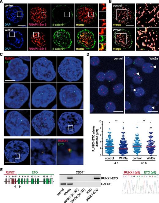 Figure 2. Wnt3a induces spatial proximity and translocation of RUNX1 and ETO in human hematopoietic progenitors. (A) Localization of β-catenin into active RNAPII transcription factories. Immunodetection of β-catenin and active RNAPII-Ser5P through confocal microscopy in CD34+ cells incubated under control conditions or in the presence of purified Wnt3a (200 ng/mL; 4 hours). White boxes indicate selected regions of interest that are shown at higher magnification at the right panel. Scale bar represents 5 μm. (B) Surface-rendered CD34+ cells (as depicted in panel A) and zoom in (4×; white boxes) showing colocalization of β-catenin and RNAPII-Ser5P in Wnt3a-treated cells. (C) Representative confocal images of RNA-FISH experiments in CD34+ cells upon 4-hour treatment with 200 ng/mL purified Wnt3a (number of cells and other parameters are given in supplemental Table 2). RUNX1 alleles are shown in red and ETO alleles in green. Scale bar represents 4 μm. Selected region of interest (white box) is shown at higher magnification below as a maximum intensity projection reconstruction for 4,6 diamidino-2-phenylindole (DAPI) and signal rendering for RUNX1 (red) and ETO (green). Scale bar represents 4 μm. Zoom in (4× and 8×; middle and right, respectively) corresponds to region of interest defined above. (D) Representative confocal images of DNA-FISH experiments in control and Wnt3a-treated CD34+ cells (4 hours) (top). White arrowheads in Wnt3a-treated cells indicate RUNX1 (red) and ETO (green) alleles with a distance of less than 1 μm. Scale bar represents 10 μm. Scatterplot showing shortest distances between RUNX1 and ETO alleles in control and Wnt3a-treated cells for 4 and 48 hours (bottom) (number of cells and other parameters are given in supplemental Table 3). The median in each group is depicted as a red line. Statistical significance was determined by a Mann-Whitney U test (***P < .0001; NS, nonsignificant). (E) Wnt/β-catenin signaling induces a common RUNX1-ETO translocation event. Diagram representing a recurrent RUNX1-ETO translocation event (left). Detection of RUNX1-ETO fusion gene and GAPDH products in CD34+ cells following long-term treatment with Wnt3a for 48 hours (middle). Chromatogram of the band shown for CD34+ cells treated with Wnt3a (48 hours) (right). no RT, no reverse transcription; pAML1-ETO, amplification of RUNX1-ETO from chimeric plasmid pCMV5-AML1-ETO.