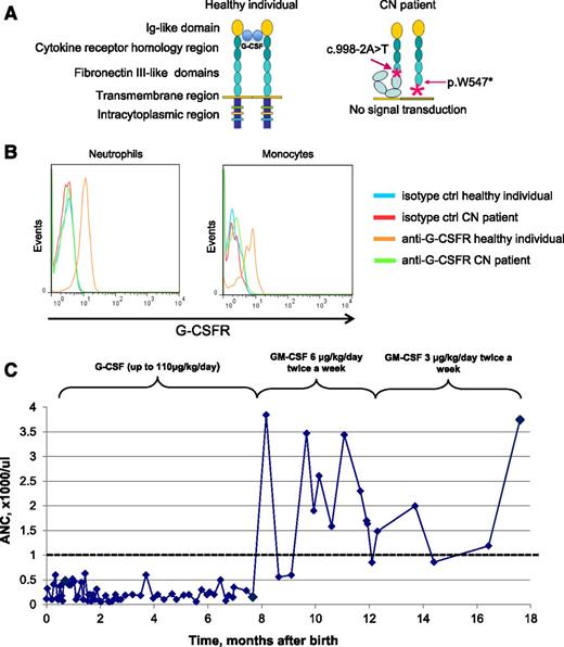 Figure 1. Biallelic CSF3R mutations detected in the CN patient leading to the absence of G-CSFR surface expression and G-CSF unresponsiveness. (A) Schematic representation of the wild-type G-CSFR and the mutant G-CSFR in the CN patient. The wild-type G-CSFR is composed of an extracellular part, a transmembrane region, and an intracellular domain. The extracellular part of the receptor includes an immunoglobulin (Ig)-like module, the cytokine receptor homology domain, and 3 fibronectin type III modules. Upon G-CSF binding to its receptor, a 2:2 tetrameric complex is formed. The intracellular domain is essential for the transduction of proliferation and differentiation signals. Both mutations identified in the CN patient alter the G-CSFR molecular composition either by creating a premature stop-codon or by shifting the codon frame and introducing spurious amino acids. (B) Absence of G-CSFR expression on the surface of the patient’s granulocytes and monocytes. The patient and healthy donor blood samples were stained with an allophycocyanin (APC)-conjugated anti-G-CSFR antibody, and surface G-CSFR expression on the patient’s granulocytes and monocytes was measured by flow cytometry. No surface expression of G-CSFR protein was detected. Cells from healthy donors were used as a positive control (ctrl). Representative histograms showing G-CSFR staining in the CN patient and healthy donor are depicted. (C) ANC and response to GM-CSF/G-CSF in the CN patient during the course of treatment. After 7 months of G-CSF administration, the patient still failed to produce neutrophils in an amount sufficient to protect against recurrent bacterial infection. After GM-CSF administration, the patient’s neutrophil count rose significantly to more than 1000 cells per microliter (range, 860-3744 cells per microliter), allowing the GM-CSF dose to be reduced to 3 µg/kg twice a week. After 6 months of successful treatment with GM-CSF, the patient was again prescribed G-CSF. Because G-CSF therapy produced no effect on neutrophil count, it was replaced with GM-CSF therapy (data not shown).