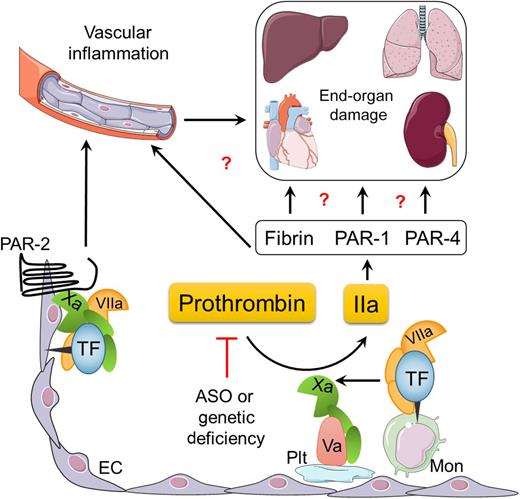 Proposed mechanisms by which the TF-thrombin pathway may contribute to the pathology of SCD. ASO, antisense oligonucleotides; EC, endothelial cell; IIa, thrombin; Mon, monocyte; PAR, protease-activated receptor; Plt, platelet. Illustration designed and prepared by Dr Erica Sparkenbaugh.