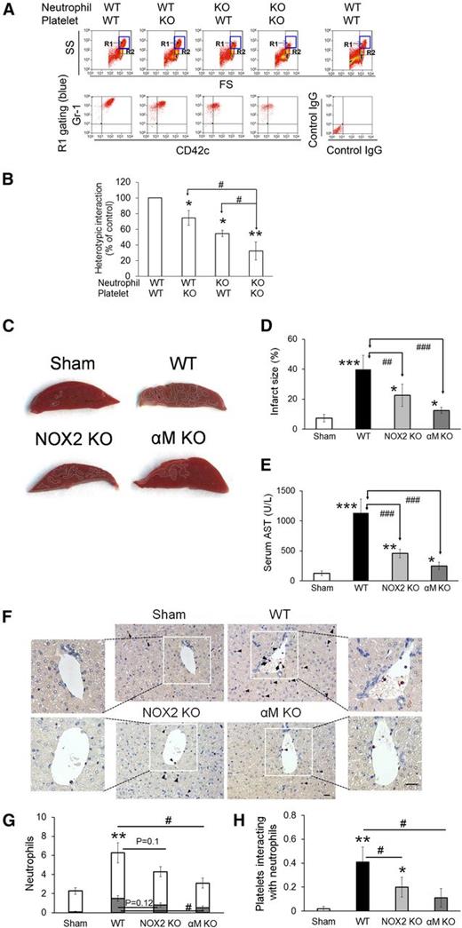 Figure 5. NOX2 is important for neutrophil-platelet aggregation under stirring conditions and for hepatic ischemia/reperfusion injury in vivo. (A-B) In vitro neutrophil-platelet aggregation assay was performed as described in the “Methods” section. Neutrophils and platelets isolated from WT and NOX2 KO mice were labeled with Alexa Fluor 647-conjugated anti-Gr-1 and Dylight 488-conjugated anti-CD42c antibodies, respectively. Thrombin-activated platelets were mixed with TNF-α-treated neutrophils under stirring conditions (1000 rpm). Cells were analyzed by flow cytometry. R1 designates leukocyte-platelet aggregates and R2 designates total population of neutrophils. Neutrophil-platelet aggregation was measured by the fluorescence intensity of anti-CD42c antibodies (B) in the R1 gate. Data represent the mean ± SD (n = 3). SS, side scatter; FS, forward scatter. (C-F) Hepatic ischemia/reperfusion injury was induced as described in the “Methods” section. (C) Representative pictures of liver sections stained with triphenyltetrazolium chloride. (D) Infarct sizes (white areas in C) were measured by Image J. (E) Serum levels of aspartate aminotransferase (AST). (F) Neutrophils (arrow heads) and platelets (arrows) in liver sections were stained with an esterase kit (pink) and anti-CD41 antibodies (brown), respectively. Nucleated cells were stained with hematoxylin (purple). Bar = 20 μm. (G) The number of neutrophils was counted inside (gray) and outside (white) the hepatic vessels. (H) The number of platelets that interact with adherent neutrophils to the vessels was counted. Data represent the mean ± SD (n = 5 mice and 15 sections in 5 mice for G-H). *P < .05, **P < .01, or ***P < .001 vs WT control or sham after ANOVA and Dunnett’s test. In (G), **P < .01 was obtained after comparison of the total number of neutrophils. #P < .05, ##P < .01, and ###P < .001 between 2 groups after Student t test.