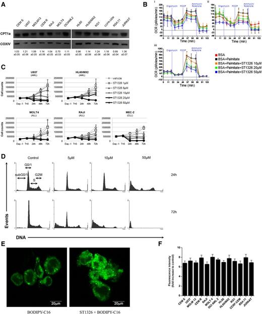 Figure 1. ST1326 induces FAO decrease, palmitate accumulation, and apoptosis in leukemia cell lines. (A) CPT1a expression in isolated mitochondria of leukemia cell lines. Cytochrome c oxidase subunit IV (COXIV) was used as housekeeping. Densitometry values of CPT1a/COXIV ratio are reported for each cell line as mean ± standard deviation (SD) of 3 independent experiments. (B) ST1326 induces FAO decrease in cell line and primary AML cells. Time course of a representative FAO experiment on U937 (i), MOLT4 (ii), and MEC-2 (iii) cell lines exposed to increasing concentrations of ST1326. BSA, bovine serum albumin; OCR, oxygen consumption rate. (C) ST1326 induces cell growth arrest in dose- and time-dependent fashion in hematopoietic cell lines with different ontogenesis. Dose-response growth curves: several hematopoietic cell lines were exposed to increasing concentrations of ST1326 for the indicated periods of time. Cell counts and viability were then assessed by trypan blue exclusion counting. (D) ST1326 induces a dose- and time-dependent cell cycle modulation and apoptosis in U937 cells. U937 cells were exposed to the indicated concentrations of ST1326 or vehicle control up to 72 h. Distribution of cells in the different phases of cell cycle and in the sub-G0/1 peak was assessed by acridine orange DNA/RNA staining as described.16,17 DNA histograms show results of 1 representative experiment performed on U937 cells. (E) ST1326 induces intracellular palmitate accumulation. Representative images of U937 cells stained with 4,4-difluoro-5,7-dimethyl-4-bora-3a,4a-diaza-s-indacene-3-hexadecanoic acid (BODIPY-C16) with or without ST1326 treatment as described in “Study design.” Images were acquired with laser scanning confocal microscope (TCS SP2 AOBS; Leica Microsystems, Mannheim, Germany) using a ×40 (numerical aperture = 1.25) oil immersion lens with optical pinhole at 1 AU. Scale bar indicates 20 μm. (F) Effects of ST1326 on palmitate accumulation. Relative BODIPY-C16 uptake is expressed as fluorescence intensities (mean ± SD of 3 independent experiments) in leukemia cell lines exposed to ST1326 as compared with the respective untreated controls. The increase of fluorescence intensities in ST1326-exposed cells is proportional to the intracellular palmitate accumulation (details in supplemental Materials and methods).