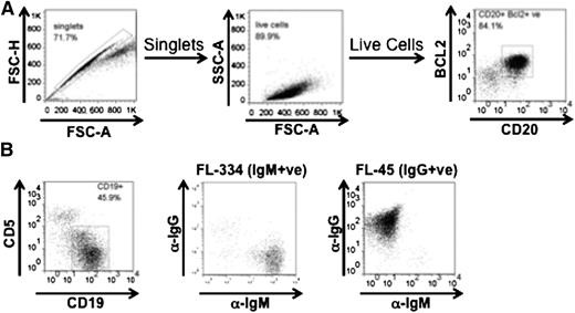 Figure 1. Characterization of FL cells. Phenotyping of representative patients used in this study, including FACS plots detailing gating strategy of singlet CD20+ cells to determine BCL2 expression (A) and gating of singlet, live CD19+ FL cells expressing to determine IgM (FL334) or IgG (FL45) isotype (B).