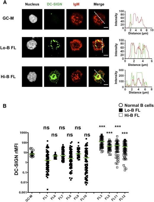Figure 3. Clustering of BCR and DC-SIGN in FL B cells. Sorted CD44−IgD− GC B cells and purified IgM+ FL B cells were incubated with unlabeled rhDC-SIGN before incubation on fibronectin-coated glass and fixation. DC-SIGN was revealed using mouse IgG2b anti-human DC-SIGN primary mAb and A488-donkey anti-mouse IgG2b secondary Ab whereas IgM+ cells were directly stained using A549-goat anti-IgM Ab. One example highlighting DC-SIGN/BCR colocalization is shown in panel A. Scale bar, 2.5 µM. The DC-SIGN:IgM rMFI was obtained for 100 cells per sample in 3 pooled GC B-cell samples, 6 IgM+ Lo-B FL samples (FL1, FL6-10), and 4 IgM+ Hi-B FL samples (FL3, FL5, FL11, FL12) (B). The Kruskal-Wallis nonparametric test followed by the Dunn posttest was used to compare FL samples with GC-M samples; ***P < .0001.