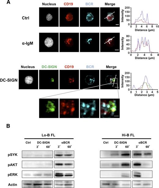 Figure 4. Induction of BCR signaling by DC-SIGN in FL B cells. (A) Purified Hi-B FL B cells were incubated with mouse IgG1 anti-human CD19 mAb alone (Ctrl) or before stimulation with mouse IgG3 anti-IgM mAb (αIgM) or rhDC-SIGN. After fixation, cells were stained with A594-goat anti-mouse IgG1 Ab, A647 goat anti-human IgM Ab, and, when appropriate, mouse IgG2b anti-DC-SIGN primary mAb and A488-donkey anti-mouse IgG2b secondary Ab. Shown is 1 experiment representative of 3. Scale bar, 2.5 µM. (B) Purified B cells from Lo-B FL and Hi-B FL samples were stimulated for the indicated time points with uncoated Dynabeads (Ctrl), mouse IgG3 anti-IgM mAb (BCR), or Dynabeads coated by rhDC-SIGN (DC-SIGN). Western blot revealed pSYK, pAKT, and pERK and were normalized using anti-β-actin. Shown is 1 experiment representative of 3.