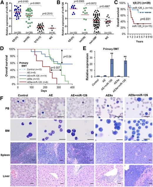 Figure 1. miR-126 expression patterns in human AML subtypes, its prognosis impact in t(8;21) AML, and its pathological effect in leukemogenesis induced by AE and AE9a fusion genes. Expression patterns of miR-126 in the In-house 85S data set (A) or the In-house 100S data set (B). The P values were calculated by 2-tailed Student t test. (C) Comparison of OS between t(8;21) AML patients with higher or lower levels of miR-126 expression (median OS, 1.9 years vs 7.0 years, respectively; P = .031) in the In-house 85S data set. Kaplan-Meier survival curves are shown. The P values were calculated by log-rank test. (D) Effect of miR-126 on AE- and AE9a-induced primary leukemogenesis. Kaplan-Meier curves are shown for 5 cohorts of transplanted mice: MSCV-PIG (control), MSCV-PIG-AML1-ETO (AE), MSCV-PIG-AML1-ETO-miR-126 (AE+miR-126), MSCV-PIG-AML1-ETO9a (AE9a), and MSCV-PIG-AML1-ETO9a-miR-126 (AE9a+miR-126). P values were calculated by log-rank test. (E) Expression of miR-126 level was detected by qRT-PCR assay in the primary BMT mouse BM cells, which were isolated and sorted by flow cytometry for CD45.2+ cells at the end point. **P < .01. (F) Wright-Giemsa–stained PB and BM, and H&E-stained spleen and liver of the primary BMT recipient mice at the end point. Bars represent 25 μm for PB and BM; 100 μm for spleen and liver. H&E, hematoxylin and eosin; _H, high; _L, low; n, number of mice studied; NC, normal hematopoietic cells; OS, overall survival; PB, peripheral blood; qRT-PCR, quantitative real-time polymerase chain reaction.