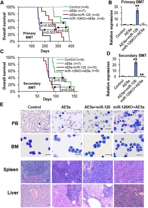 Figure 2. Knockout and overexpression of miR-126 promote AE9a-induced leukemogenesis in primary and secondary BMT. (A) The effect of the overexpression and knockout of miR-126 on AE9a-induced primary leukemogenesis in primary BMT recipient mice. Kaplan-Meier curves and P values (log-rank test) are shown. (B) Expression of miR-126 was detected by qRT-PCR assay in leukemic or control BM cells (CD45.2+) isolated from primary BMT recipient mice at the end point. **P < .01. Survival curves (C) and relative miR-126 expression levels (D) in secondary BMT recipient mice are shown. **P < .01. (E) Wright-Giemsa–stained PB and BM, and H&E-stained spleen and liver of the secondary BMT recipient mice at the end point. Bars represent 25 μm for PB and BM; 100 μm for spleen and liver.