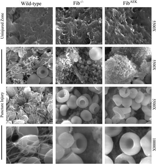 Figure 6. Failure of extravascular fibrin polymer formation in FibAEK mice following liver needle puncture injury. Representative scanning electron micrographs of right medial liver lobes from WT, Fib−/−, and FibAEK mice from uninjured areas (top row) or of the injured zone following needle puncture injury (bottom 3 rows). Note that the injured zone of WT mice was characterized by fibrin polymer structures associated with platelets and RBCs. In contrast, the injured zones of livers from both Fib−/− and FibAEK mice displayed platelet-rich clusters and RBCs, but a distinct absence of fibrin polymer structures.