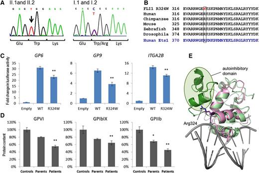 Figure 2. The FLI1 c.960C>T mutation in the ETS domain alters transcriptional activity of the protein. (A) Sequence traces showing the homozygous 970C>T mutation in patients II.1 and II.2 (left) and parents (right). (B) Amino acid homology in the ETS domain of FLI1 and ETS1. Arg324 is highly conserved among species. (C) HEK263 cells were transfected with an empty vector control, wild-type FLI1, or the mutant FLI1 c.970C>T transcript, and transcriptional activity was measured by the ratio of signal from the GP9, GP6, or ITGA2B promoter (firefly) compared with a control promoter (renilla). The data are expressed in fold change in luciferase activity and represent the mean ± standard error of the mean (N = 9) (*P < .05, **P < .01). (D) Western blotting of platelet lysates from affected (II.1, II.2) unaffected (I.1, I.2) family members, and unrelated controls representing 100%. Quantitation was performed using ImageLab software (*P < .05, **P < .01). (E) Ribbon representation of the structure of the FLI1 ETS domain in pink demonstrating the position of Arg324. Superimposed in green is the structure of the ETS1 ETS domain bound to DNA (gray). The N-terminal autoinhibitory region is shown in dark green and the core ETS domain is shown in light green.