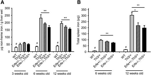 Figure 6. Ablation of Erfe in thalassemic mice decreases iron overload. Liver (A) and spleen (B) nonheme iron content was measured in WT, Th3/+, Erfe+/−, Th3/+, and Erfe−/−, Th3/+ at 3, 6, and 12 weeks of age. Mice with thalassemic trait mice had higher liver iron content at all ages compared with WT mice. Erfe-deficient mice on a thalassemic background (Erfe−/−, Th3/+) had reduced liver (A) and spleen (B) iron content compared with Th3/+ mice at 6 and 12 weeks of age. No difference in liver and spleen iron content was observed between the genotypes in 3-week-old animals, and the spleen iron content was not detectable in most of the mice at the age of 3 weeks. Data shown are means ± SEM and were compared for each age between Erfe−/−, Th3/+ or Erfe+/−, Th3/+ mice and Th3/+ mice (n = 9-36 per group) by 2-tailed Student t-test. ***P < .001, **P < .01, *P < .05. WT mice had significantly lower liver and spleen iron content compared with all the thalassemic mice (#P < .05 or less). Note that the data in A for 6-week-old mice were previously shown in Figure 7E of Kautz et al.12