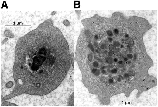 Electron micrographs of platelets from a patient homozygous for the FLI1 c.970C>T mutation show large electron-dense fused α-granules (A) when compared with a normal platelet electron micrograph (B). See Figure 1E in the article by Stevenson et al that begins on page 2027.