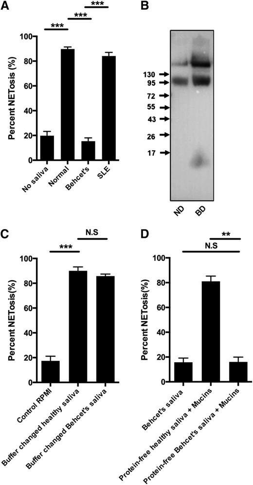 Figure 6. Deficient saliva-induced NETosis in response to saliva from patients with Behçet disease due to composition of protein-free fraction of saliva. Neutrophils were stimulated to NETosis and examined by immunofluorescence microscopy and NET formation quantified as described in “Materials and methods.” Representative images are shown in supplementary Figure 6. (A) Neutrophils were stimulated with saliva from 5 patients with Behçet disease, 5 patients with SLE or with saliva from normal donors. (B) Western blot of sialyl LewisX in saliva from normal healthy donor (ND) and patient with Behçet’s disease (BD). The same pattern was found in all samples of patients with Behçet disease. (C) NETosis of neutrophils stimulated with buffer changed saliva from ND and BD patients. (D) NETosis of neutrophils stimulated with saliva from BD patients, mucins resuspended in protein-free saliva from ND patients, and protein-free saliva from BD patients. Representative images are found in supplementary Figure 6. Columns denote average values and error bars standard deviations. N.S., not significant. **P < .01; *** P < .001.