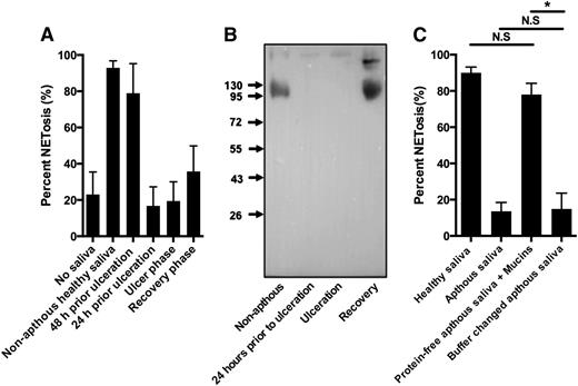 Figure 7. Deficient saliva-induced NETosis in response to saliva from patients with recurrent aphthous stomatitis due to loss of saliva sialyl LewisX. Neutrophils were stimulated to NETosis and examined by immunofluorescence microscopy and NET formation quantified as described in “Materials and methods.” Representative images are shown in supplementary Figure 7. (A) Neutrophils were stimulated with saliva from a person with recurrent aphthous stomatitis. Saliva was collected from a nonaphthous period, just prior to ulceration, from a period with ulceration, and during the recovery phase in which ulcers were still present. Error bars indicate standard deviation between 20 random images taken from each condition. Representative images and data from another person with recurrent aphthous ulcers are shown in supplementary Figure 7. (B) Western blot of sialyl LewisX in saliva from patient with recurrent aphthous stomatitis. (C) NETosis of neutrophils stimulated with saliva from healthy donor and saliva, buffer changed saliva, and mucins resuspended in protein-free saliva from a patient with recurrent aphthous stomatitis during the aphthous phase. N.S., not significant. *P < .05.
