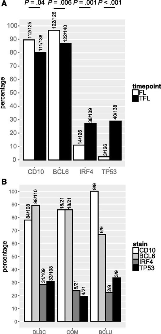 Figure 3. CD10, BCL6, IRF4 and TP53 expression in FL and TFL. (A) Prevalence of CD10, BCL6, IRF4, and TP53 expression in FL and TFL by IHC. (B) Prevalence of CD10, BCL6, IRF4, and TP53 expression in TFL by histology.