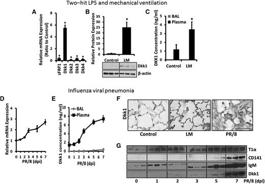 Figure 2. Dkk1 is accumulated in the lung during acute pulmonary inflammation. (A-C) Two-hit LPS and MV model. (A) The mRNA expression of Wnt antagonists (sFRP1 and Dkk1-4) in the whole-lung tissues of LM-challenged and control mice was determined by real-time PCR and plotted as the fold change over control animals with 18S rRNA as a reference gene. (B) The protein levels of Dkk1 in the whole-lung tissues of control and LM-challenged animals were measured by western blotting using β-actin as a loading control. The density of the bands was quantified by ImageJ and normalized to β-actin. The result was expressed as a ratio to control animals. (C) The Dkk1 concentrations in the BAL and plasma of LM-challenged mice were measured by ELISA. (D-G) Influenza viral pneumonia model. (D) The mRNA level of Dkk1 in the whole-lung tissues of H1N1 influenza virus PR/8-infected mice for 0 to 7 days was analyzed by real-time PCR and normalized to the control mice with 18S rRNA as a reference gene. (E) The Dkk1 concentrations in the BAL and plasma of H1N1 influenza virus PR/8-infected mice were measured by ELISA. (F) Immunostaining of Dkk1 in the lungs of control, LM-challenged, and H1N1 influenza virus PR/8-infected (7 dpi) mice. Scale bar = 75 µm. (G) The protein levels of T1α (AEC I marker), CD141 (endothelial cell marker), IgM (epithelial-endothelial barrier damage marker), and Dkk1 in the BALs of H1N1 influenza virus PR/8-infected mice (day 0 to day 7) were determined by western blotting. Data are expressed as the mean ± SEM (n = 3-8 animals) and statistical significance is determined by the Student t test. *P < .05 vs control.