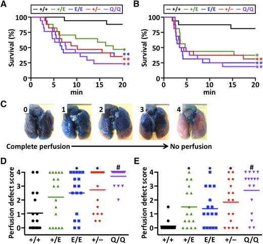 Figure 4. TF-induced PE and HMW-polyP–induced PE models. (A) Survival curve after TF infusion (n = 17/group). (B) Survival curve after HMW-polyP infusion (n = 16/group). (C) Scale to measure lung perfusion defect scores. Score of 0 indicates complete perfusion of Evans blue with no vascular occlusion, and score of 4 indicates no Evans blue perfusion with complete vascular occlusion. (D) Lung perfusion defect scores after TF infusion. (E) Lung perfusion defect scores after HMW-polyP infusion. Symbols represent data from a single mouse. Bars represent the mean values of groups. *P < .05 in comparison with Pros1+/+ mice. **P < .005 in comparison with Pros1+/+ mice. #P < .001 in comparison with Pros1+/+ mice, and P < .05 in comparison with Pros1+/E and Pros1E/E mice.