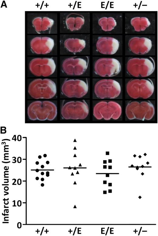 Figure 5. Transient MCA occlusion model using the 3-VO technique. (A) Representative images of coronal sections of Pros1+/+, Pros1+/E, Pros1E/E, and Pros1+/− mouse brains. (B) Infarct volumes. No significant differences (P > .05) were observed among the groups. Symbols represent data from a single mouse. Bars represent the mean values of groups.