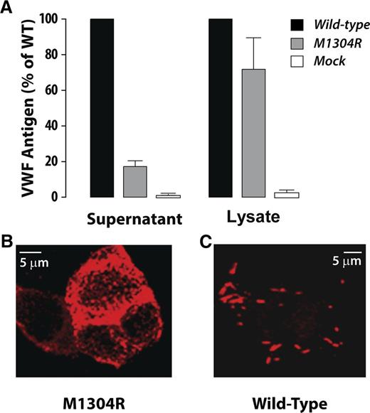 Figure 4. Defects in secretion and pseudo Weibel-Palade body formation of recombinant M1304R VWF. (A) Expression of recombinant mutant or wild-type VWF. HEK293T cells were transfected with cDNAs for either wild-type or mutant VWF and the concentrations of recombinant VWF were assessed in both conditioned media (supernatant) and cell lysate by enzyme-linked immunosorbent assay. The VWF concentration in the media (supernatant) was markedly lower for the mutant than for the wild-type, although the intracellular concentrations were similar (lysate). The concentration of wild-type VWF was normalized to 100% and that of the mutant VWF was presented relative to this value. Each bar represents the mean ± standard deviation of at least 3 separate experiments. VWF inside the transfected cells was examined by immuno-staining and confocal microscopy (B,C). (B) Cells transfected with M1304R VWF showed diffuse intracellular VWF staining indicating that the mutant was defective in forming storage granules. (C) Cells transfected with wild-type VWF showed punctate staining of VWF localized to granules resembling Weibel-Palade bodies.