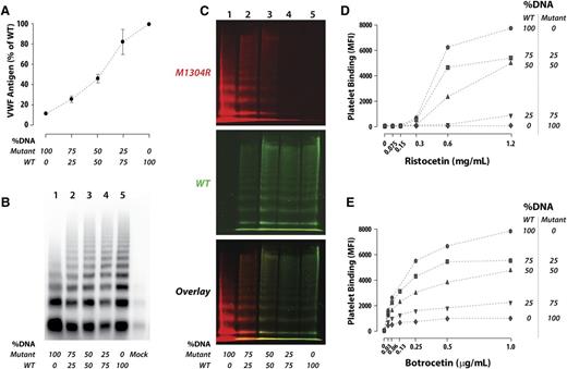Figure 5. Increased expression of wild-type VWF corrects the biosynthetic and functional defects caused by the M1304R mutation. cDNAs for wild-type and mutant VWF were cotransfected at different ratios into HEK293T cells, and biosynthetic and functional parameters were examined. (A) VWF concentration in the condition medium of transfected cells. As the ratio of wild-type to mutant cDNA increased, VWF concentration in the condition medium also increased. (B) Recombinant VWF multimer patterns. The mutant VWF multimers lack the medium- and high-molecular-weight multimers (lane 1). As the percentage of wild-type cDNA increased, the multimer size of the recombinant VWF also increased (lanes 2-4). (C) Detection of mutant and wild-type VWF in the multimers. The recombinant M1304R VWF (no tag) is detected by antibody AVW-5. The wild-type VWF with myc-His tags was coexpressed with the mutant. The presence of the myc-His tags disrupts the AVW5 epitope and the antibody can no longer recognize the wild-type VWF, which is detected by anti-myc antibody. Mutant VWF (red) was detected in all multimer bands when coexpressed with the wild-type (green) (lanes 2 and 3 in panel C). When the mutant cDNA composed only 25% of the transfected cDNA, the mutant protein was detected only in low-molecular-weight multimers (lane 4 in panel C). (D) Ristocetin-induced platelet binding. (E) Botrocetin-induced platelet binding. In both panels D and E, the M1304R mutation resulted in defective platelet binding, which tended to normalize with an increasing percentage of the wild-type cDNA in cotransfection.