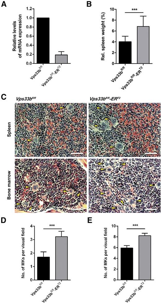 Figure 1. Characterization of the Vps33bfl/fl-ERT2 mice. (A) Analysis of Vps33b messenger RNA in BM-derived MKs of Vps33bfl/fl and Vps33bfl/fl-ERT2 mice. (B) Spleen to body weight ratio was analyzed in 11-week-old mice 5 weeks post-induction (n = 12 to 16 mice per genotype). (C) Extramedullary hematopoiesis in Vps33bfl/fl-ERT2 mice. Representative images of hematoxylin and eosin-stained spleen (top panels) and femur BM (bottom panels) sections from littermate controls (left top and bottom panels) and Vps33bfl/fl-ERT2 mice (right top and bottom panels). MKs are indicated by yellow arrowheads (n = 3 mice per genotype). Bright field images were obtained using a Zeiss Axiovert 200 inverted high-end microscope with a 20× objective. Scale bar, 50 μm. (D-E) Determination of MK numbers per visual field (294 × 221 μm, 36 fields of view from 3 mice per genotype) in hematoxylin and eosin-stained spleen (D) and BM (E) sections of Vps33bfl/fl vs Vps33bfl/fl-ERT2 mice. Mean ± SEM. All values are mean ± standard deviation (SD) unless otherwise indicated. ***P < .001.